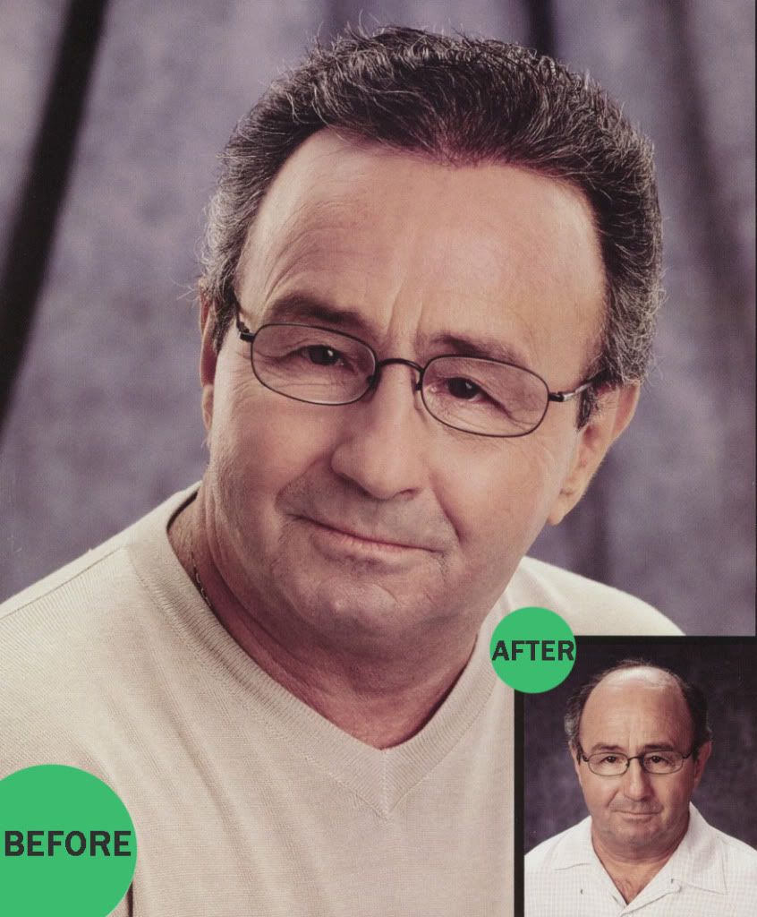 hair photo:treating hair loss 