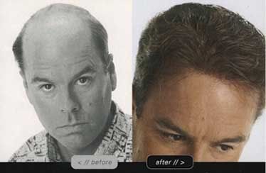 hair photo:reasons for female hair loss 